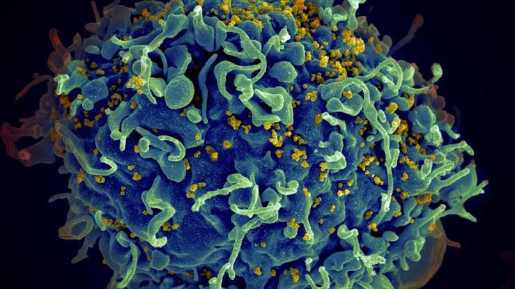 CCR5-delta32: entenda a mutação ligada à remissão do HIV