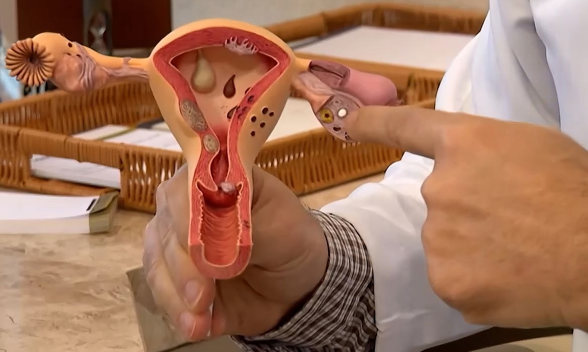 CNPq abre inscrições para edital sobre endometriose e dor pélvica